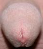 ... die Spitze